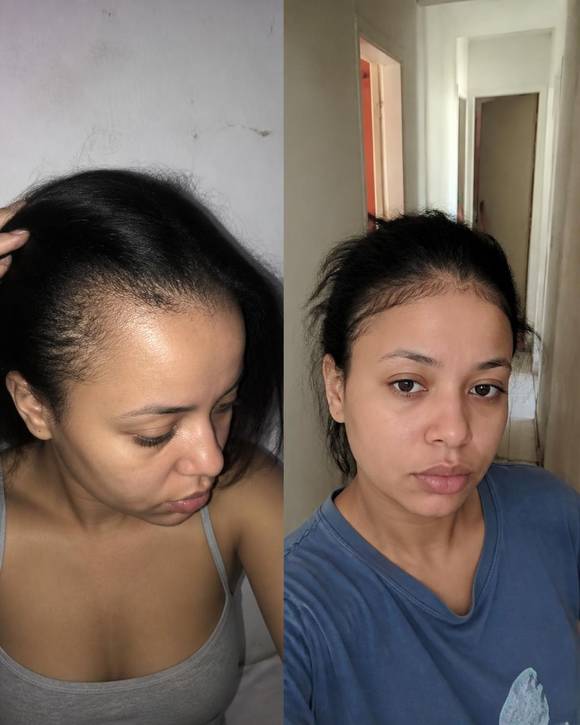 Aline, 29